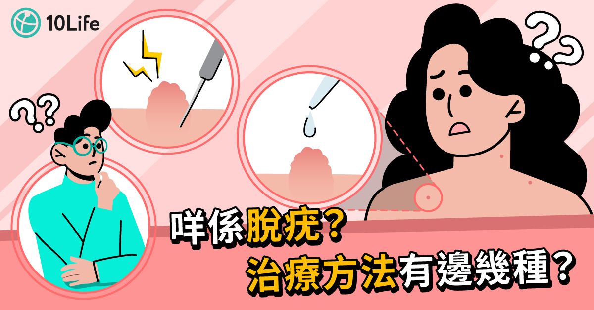 【脫疣價錢2023】5種脫疣治療有咩分別?拆解Claim保險注意事項